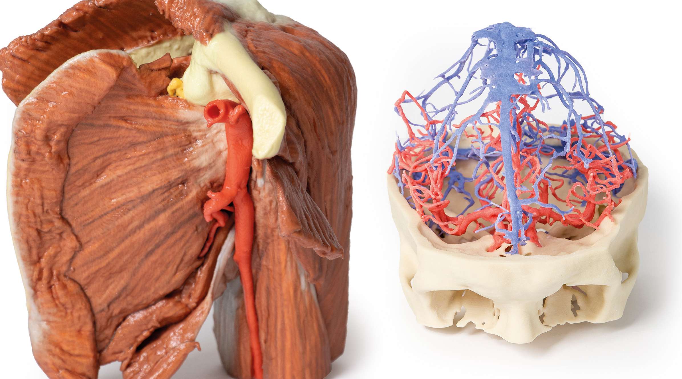 Plastinated Specimens vs 3D Printed Models — Which Is Better for Teaching?